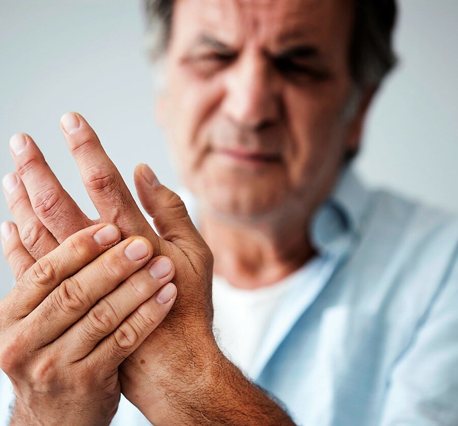 Senior man holds his hand, as he's suffering from arthritis pain. Read these tips from Bethesda to manage arthritis pain during the winter months.