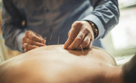 A man receives acupuncture from a female technician as a form of chronic pain management.
