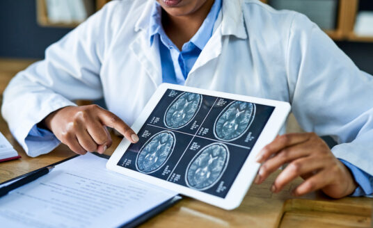 A doctor using brain scans on a tablet to demonstrate what happens to your brain as you age.